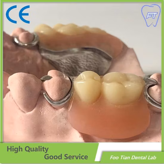 Cobalt Chrome Casting Framework Removable Denture Customized