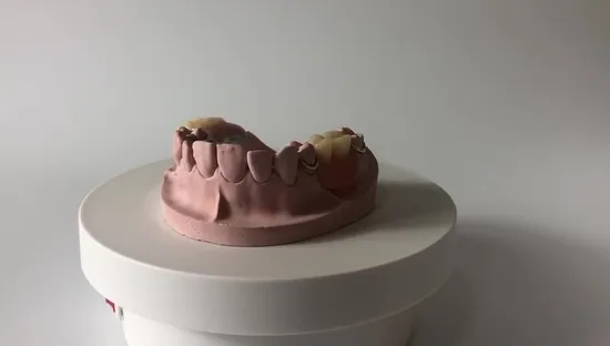 Cobalt Chrome Casting Framework Removable Denture Customized
