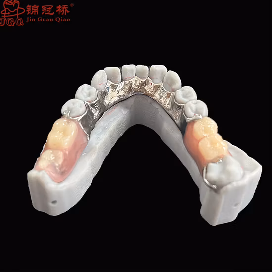 High Quality Removable Metal Framework Denture