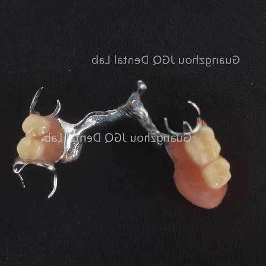 High Quality Removable Metal Framework Denture